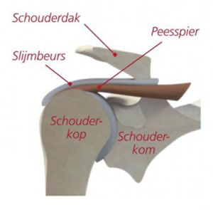 schouderklachten